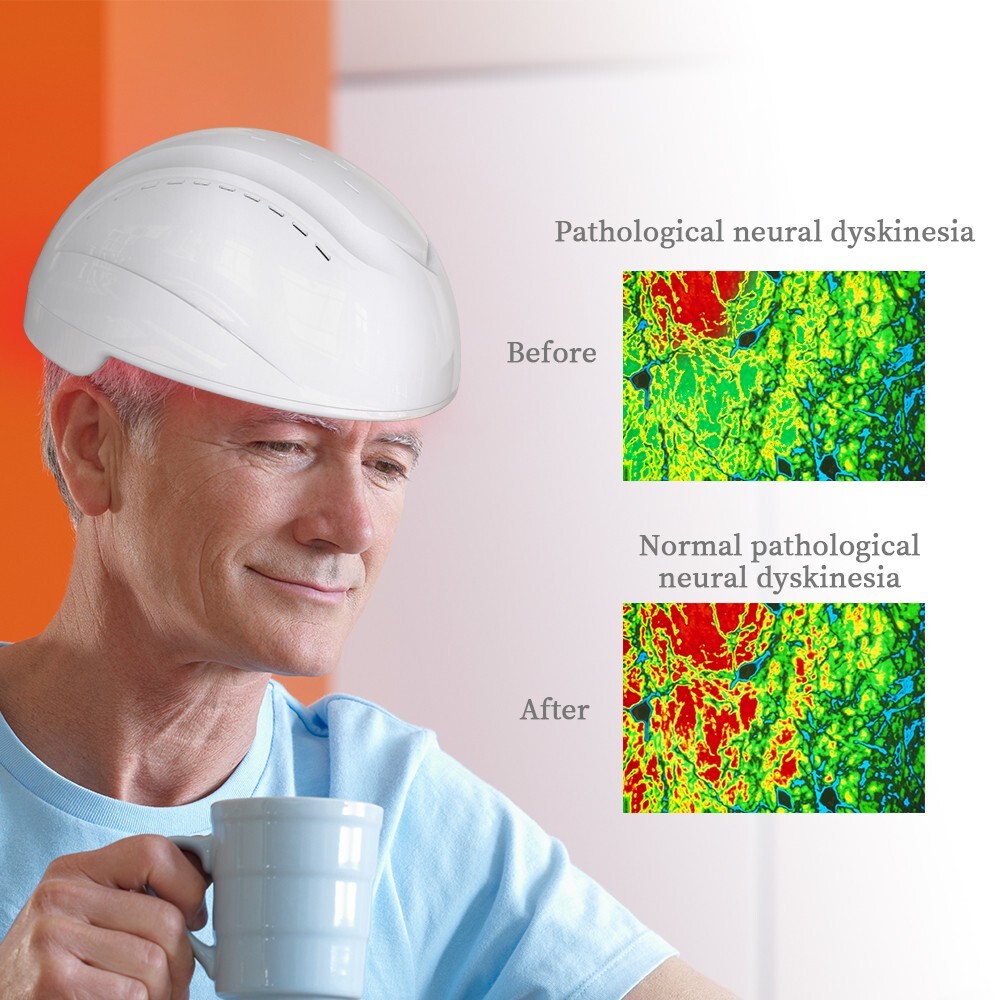 Medical Neuron Stimulation 810nm PBM Helmet Brain Disorder Rehabilitation